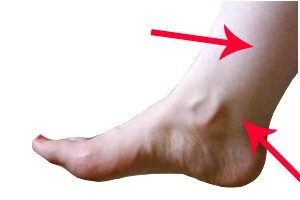 ankle point